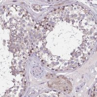 Anti-CHST3 antibody produced in rabbit 