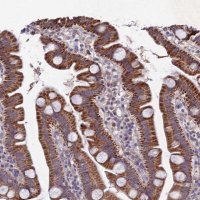 Anti-CHST5 antibody produced in rabbit 