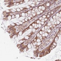 Anti-CHURC1 antibody produced in rabbit 
