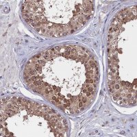 Anti-CIAPIN1 antibody produced in rabbit 
