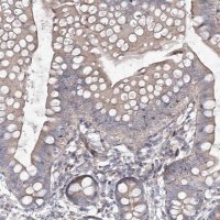 Anti-CIB2 antibody produced in rabbit 