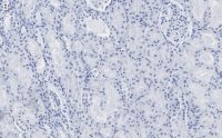 Anti-Claudin 6 Antibody, clone 1B22 ZooMAb Rabbit Monoclonal 