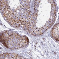 Anti-CLCN7 antibody produced in rabbit 