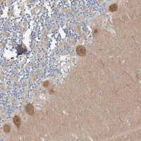 Anti-CLDND1 antibody produced in rabbit HPA029841-100UL
