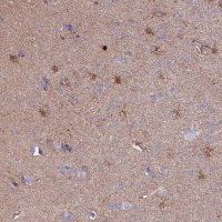 Anti-CLEC2L antibody produced in rabbit 