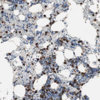 Anti-CLEC4D antibody produced in rabbit 