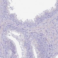 Anti-CLEC4M antibody produced in rabbit 