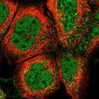 Anti-CLEC7A antibody produced in rabbit 