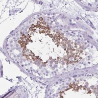 Anti-CLGN antibody produced in rabbit 