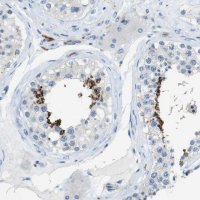 Anti-CLMN antibody produced in rabbit 