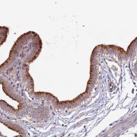 Anti-CLN5 antibody produced in rabbit 