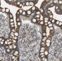 Anti-CLRN3 antibody produced in rabbit HPA014482-100UL