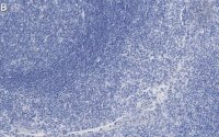 Anti-Clusterin Antibody, clone 2F23 ZooMAb Rabbit Monoclonal 