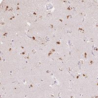 Anti-CLVS1 antibody produced in rabbit HPA053869-100UL