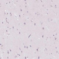 Anti-CMA1 antibody produced in rabbit 