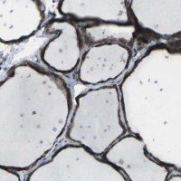 Anti-CMTM4 antibody produced in rabbit 