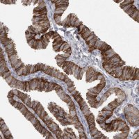 Anti-CMTM6 antibody produced in rabbit 