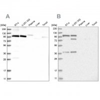 Anti-CMTR1 antibody produced in rabbit 