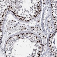 Anti-CMTR1 antibody produced in rabbit HPA029954-100UL