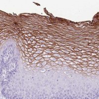 Anti-CNFN antibody produced in rabbit 