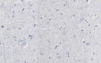 Anti-CNTNAP2 Antibody, clone 2D17 ZooMAb Rabbit Monoclonal 
