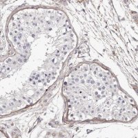 Anti-COL6A1 antibody produced in rabbit 