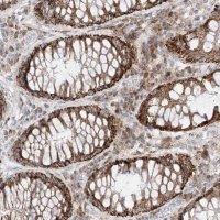 Anti-COLGALT2 antibody produced in rabbit HPA031750-100UL