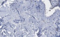 Anti-Collagen Type III Antibody, clone 3N18 ZooMAb Rabbit Monoclonal 