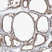 Anti-COMMD8 antibody produced in rabbit 