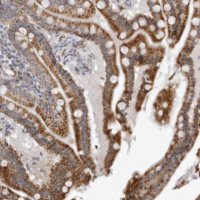 Anti-CPT2 antibody produced in rabbit 