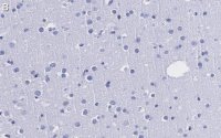Anti-CRBN Antibody, clone 3I23 ZooMAb Rabbit Monoclonal 
