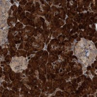 Anti-CREB3L1 antibody produced in rabbit 