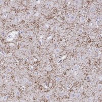 Anti-CREG2 antibody produced in rabbit 