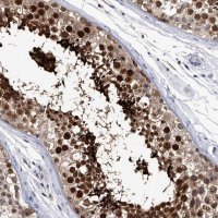 Anti-CRISP2 antibody produced in rabbit 