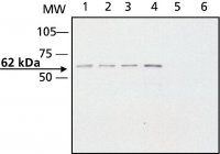 Anti-CRMP2 antibody produced in rabbit C2993-200UL