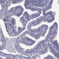 Anti-CROCC2 antibody produced in rabbit 