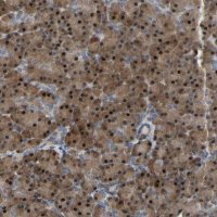 Anti-CROT antibody produced in rabbit 