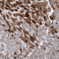 Anti-CRP antibody produced in rabbit 