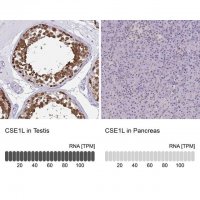 Anti-CSE1L antibody produced in rabbit 