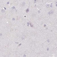 Anti-CSN1S1 antibody produced in rabbit 