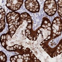 Anti-CSNK1G2 antibody produced in rabbit HPA034868-100UL