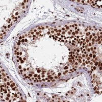 Anti-CTB-50L17.10 antibody produced in rabbit 