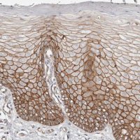Anti-CTNNB1 antibody produced in rabbit 