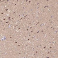 Anti-CTNND2 antibody produced in rabbit 