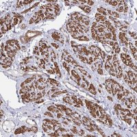 Anti-CTPS1 antibody produced in rabbit HPA051322-100UL