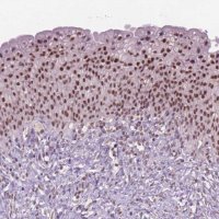 Anti-CTR9 antibody produced in rabbit 