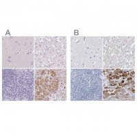 Anti-CTRL antibody produced in rabbit 