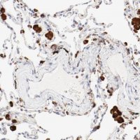 Anti-CTSH antibody produced in rabbit 