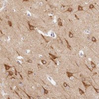 Anti-CTTNBP2 antibody produced in rabbit 
