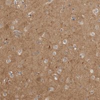 Anti-CUEDC1 antibody produced in rabbit 